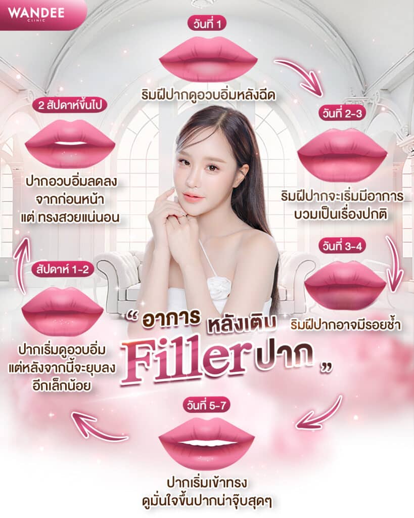 ฉีดฟิลเลอร์ปาก หมอไหนดี