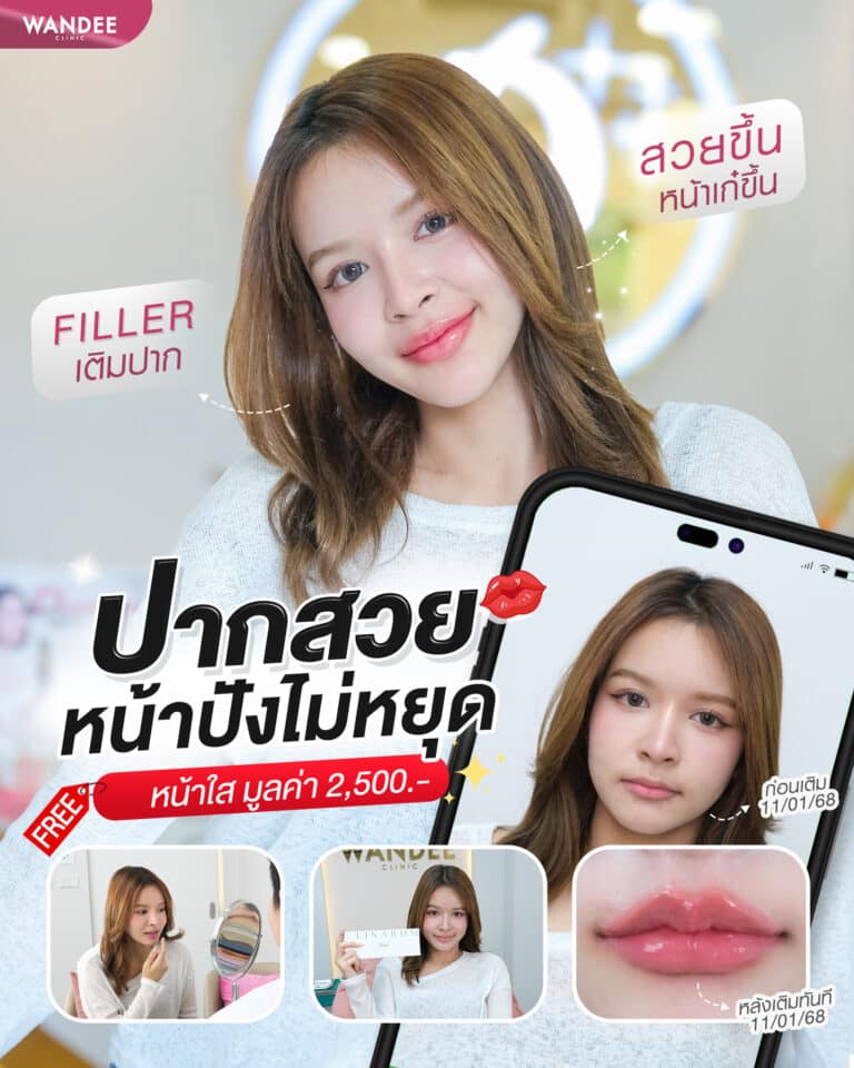 ฟิลเลอร์